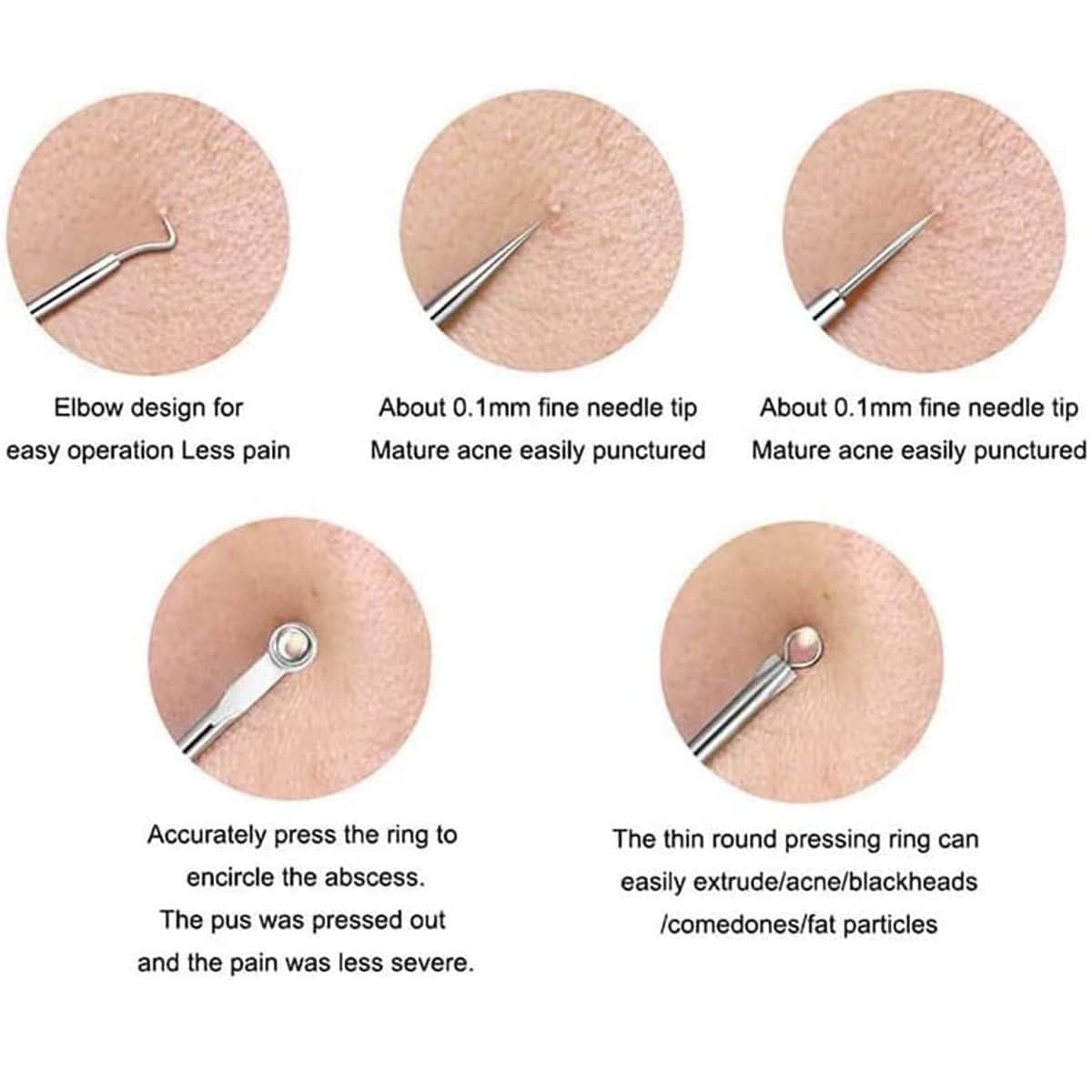 Pink Line Blackhead Remover Tool Kit - 4 in 1 Acne and Pimple Removal Tool - Nose & Face Blackheads Remover