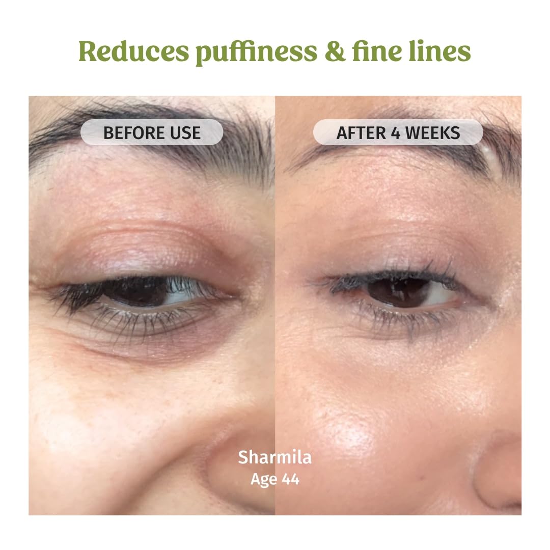 Vilvah Under Eye Cream | Reduces Dark Circles, Puffiness & Eye Bags | Hydrates, Smoothens Fine Lines & Firms Skin | Lightweight Eye Care for Tired Eyes | 20ml