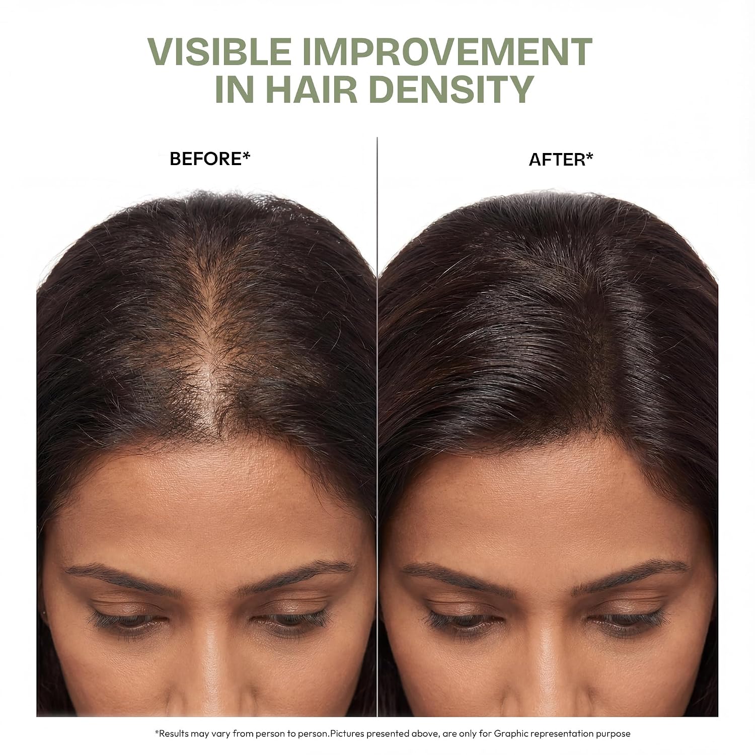 Proskire Ultimate Hair Growth Oil | Lightweight Non-Greasy Hair Growth Oil with Rosemary, Batana & Bhringraj | Reduces Hair Fall & Boosts Hair Density - 100ml