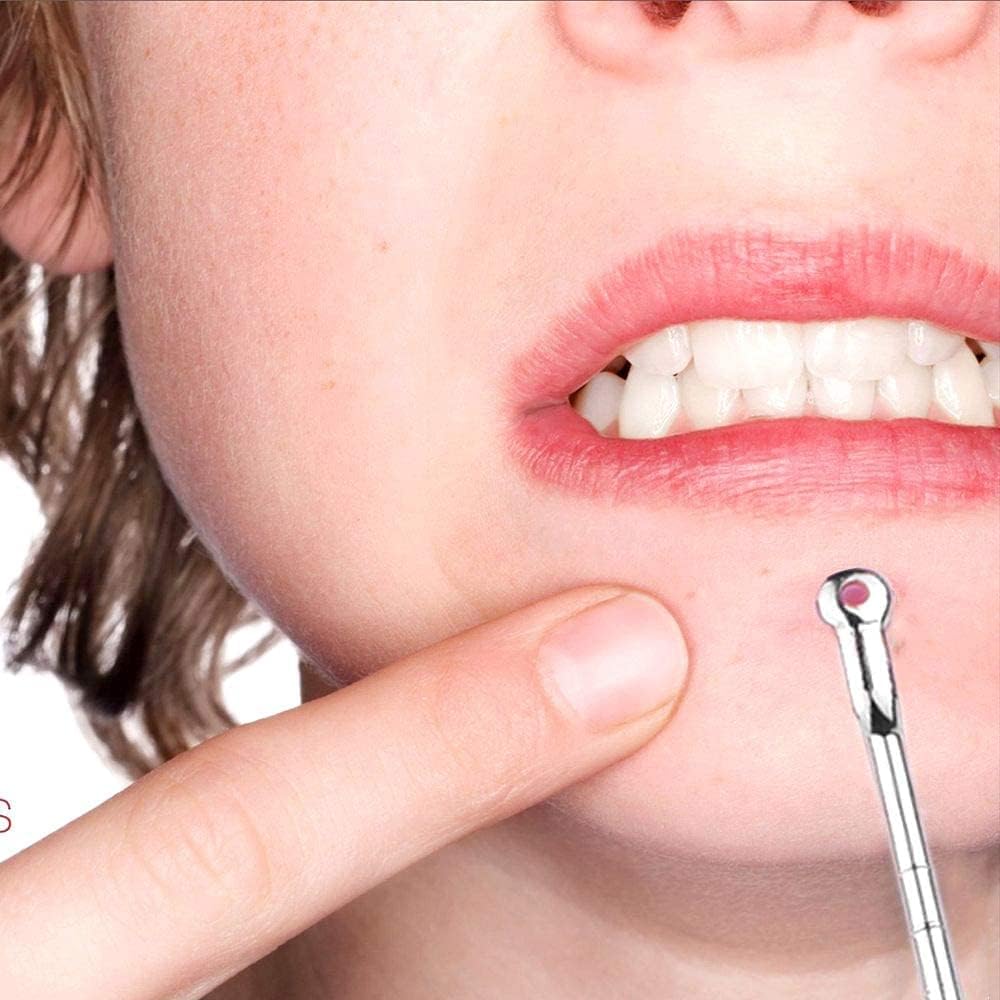 Pink Line Blackhead Remover Tool Kit - 4 in 1 Acne and Pimple Removal Tool - Nose & Face Blackheads Remover